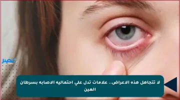 لا تتجاهل هذه الأعراض.. علامات تدل على احتمالية الإصابة بسرطان العين